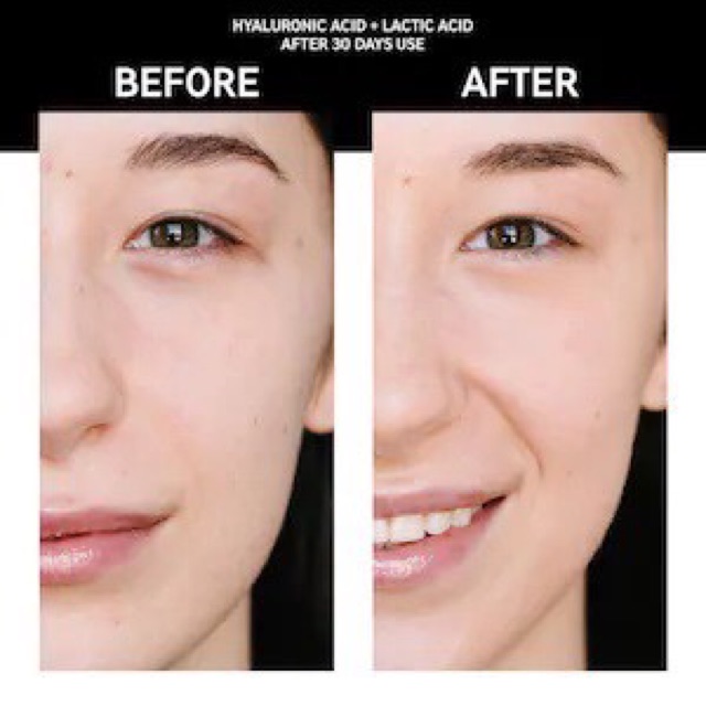 Serum Dưỡng Ẩm Chống Lão Hóa The Inkey List Hyaluronic Acid 30ml