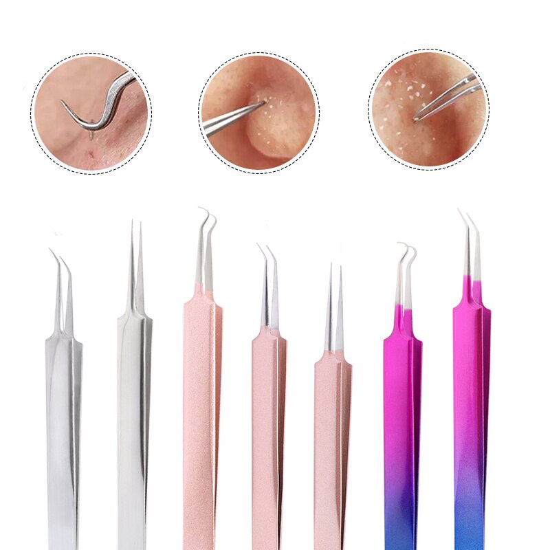 3 đầu tóc đen Comedone Đốm đen vùng khuyết tật mụn giày da để chăm sóc việc điều trị da phụ nữ để làm sạch mụn trứng cá ngoài lỗ chân cá