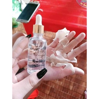 Lột Da Nn . lột bong mảng to
