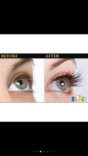 Serum dưỡng mi RapidLash