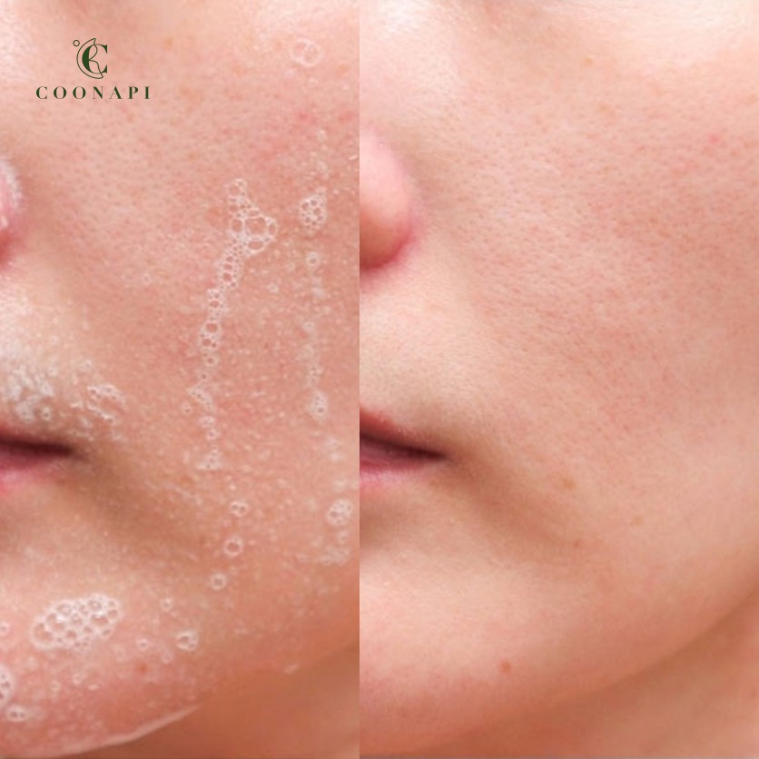 Sữa Rửa Mặt Thảo Mộc Dưỡng Ẩm Và Làm Dịu Da Nature's Friend Cleansing Foam 150g | BigBuy360 - bigbuy360.vn