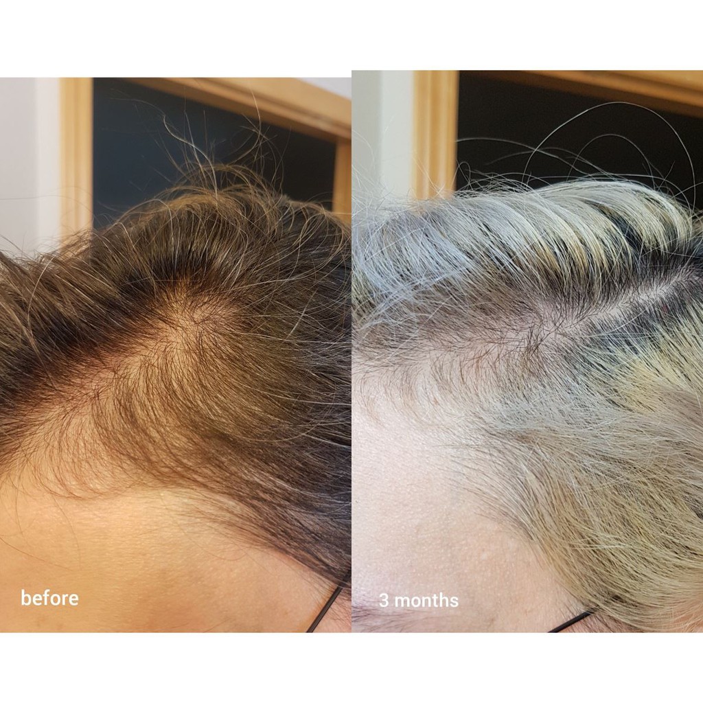 SERUM Dưỡng Tóc Multi- Peptide For Hair Destiny 60ml