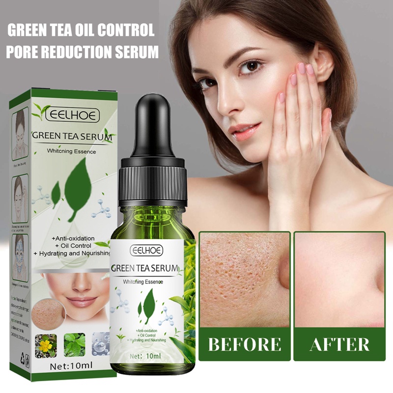 Serum Trà Xanh Kiểm Soát Dầu Thu Nhỏ Lỗ Chân Lông Làm Trắng Da Loại Bỏ Đốm Đen Cải Thiện