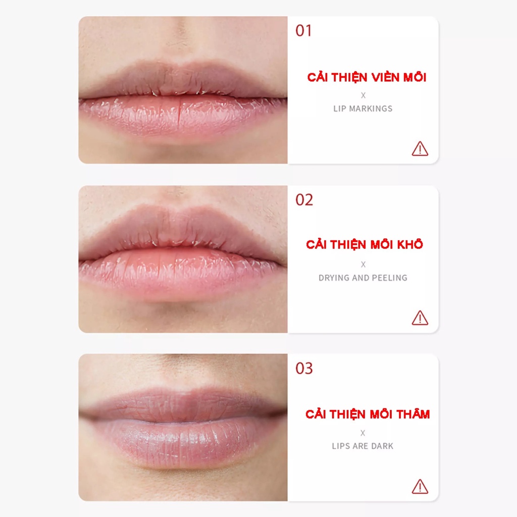 Hộp 20 miếng - MẶT NẠ DƯỠNG HỒNG MÔI - Hàng chính hãng