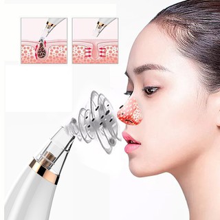 máy hút mụn đầu đen