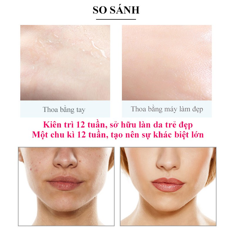 Máy Massage Mặt [FreeShip] Làm Đẹp Da Photon Nóng Và Lạnh EMS Nâng Cơ Mặt Tăng Hấp Thụ Khóa Giữ Chất  Dưỡng | BigBuy360 - bigbuy360.vn