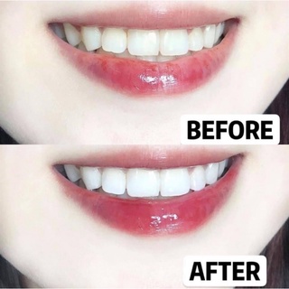 Bột tẩy trắng răng Eucryl