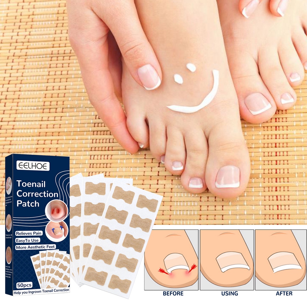 Bộ 50 Miếng Dán Chỉnh Sửa Móng Chân Chống Nước