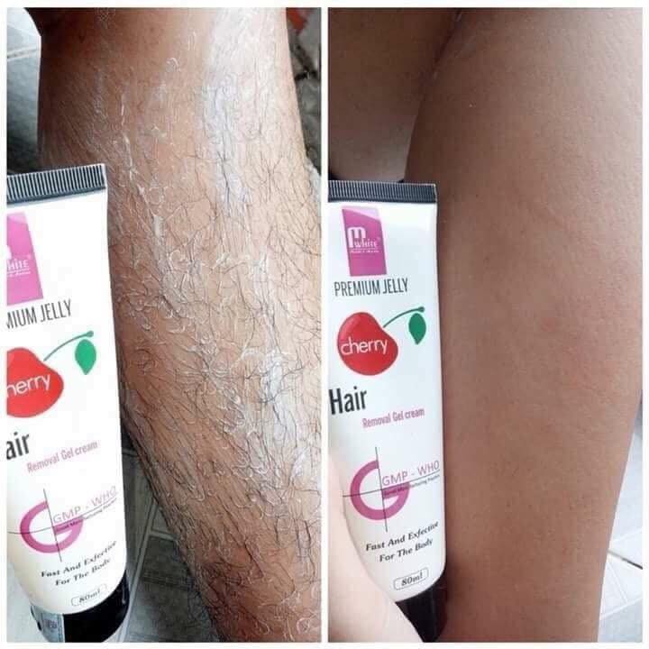 TRIỆT LÔNG TẨY LÔNG MWHITE CHÍNH HÃNG | BigBuy360 - bigbuy360.vn