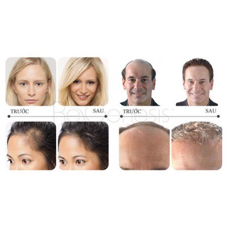 Serum kích mọc tóc Andrea (2sp sỉ)