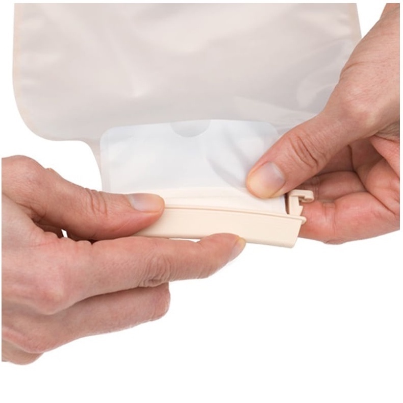 Kẹp miệng túi hậu môn nhân tạo