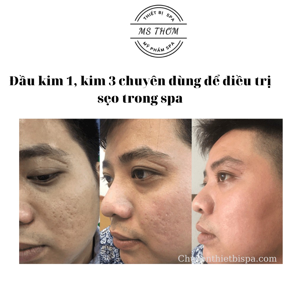 Đầu kim 1 và 3, phá đáy sẹo chuyên dùng trong spa/thẩm mỹ viện