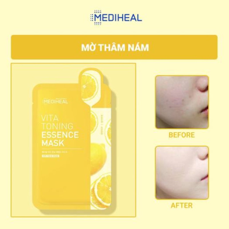 Mặt nạ Mediheal chăm sóc mọi loại da mẫu mới 2021