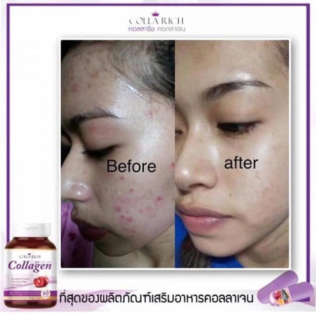 Viên collagen hũ 60 viên | BigBuy360 - bigbuy360.vn