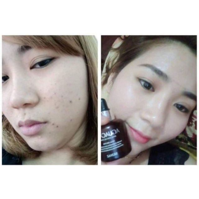TINH CHẤT BƠ DƯỠNG DA KHỎE CĂNG BÓNG SÁNG HỒNG SKINAZ HÀN QUỐC