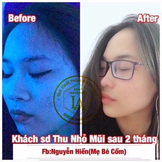 Tinh Chất Thu Nhỏ Mũi Pháp