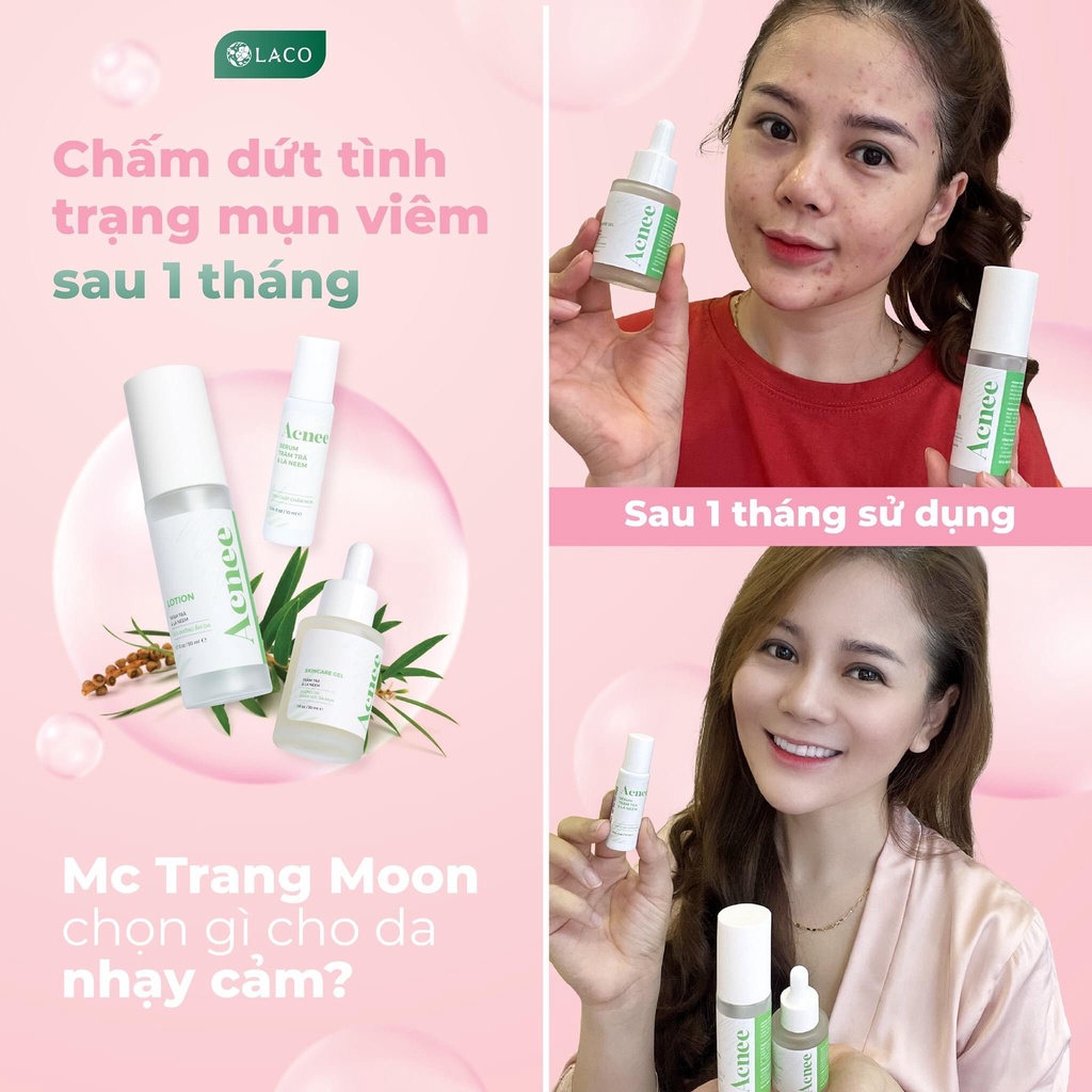 Sữa dưỡng ẩm Lotion Acnee tràm trà và lá neem LACO 50ml giảm mụn giảm thiểu các vùng da bị nổi mụn và cấp ẩm cho làn da