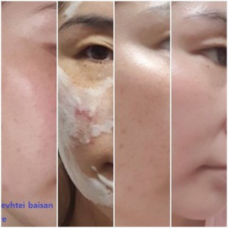 Thần dược làm trắng da Bubble toc toc serum