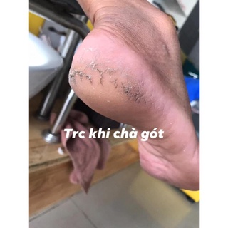 (giá sỉ) Dụng cụ chà/mài gót chân 4 in 1