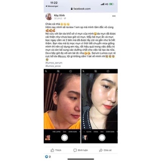 Serum giảm mụn, chấm thâm mụn Lumos Acne 5ml