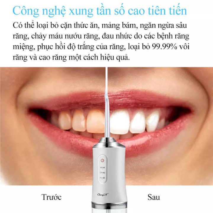 Máy tăm nước cầm tay,tăm nước vệ sinh răng Oral Irrigator, 4 đầu tăm,mẫu mới nhất 2021