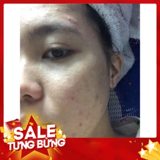 Combo tri mun Dr mai [CHÍNH HÃNG] ✅