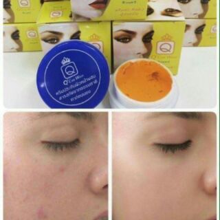 🌱🌱🌱Kem nghệ Q CARE WHITE thailan