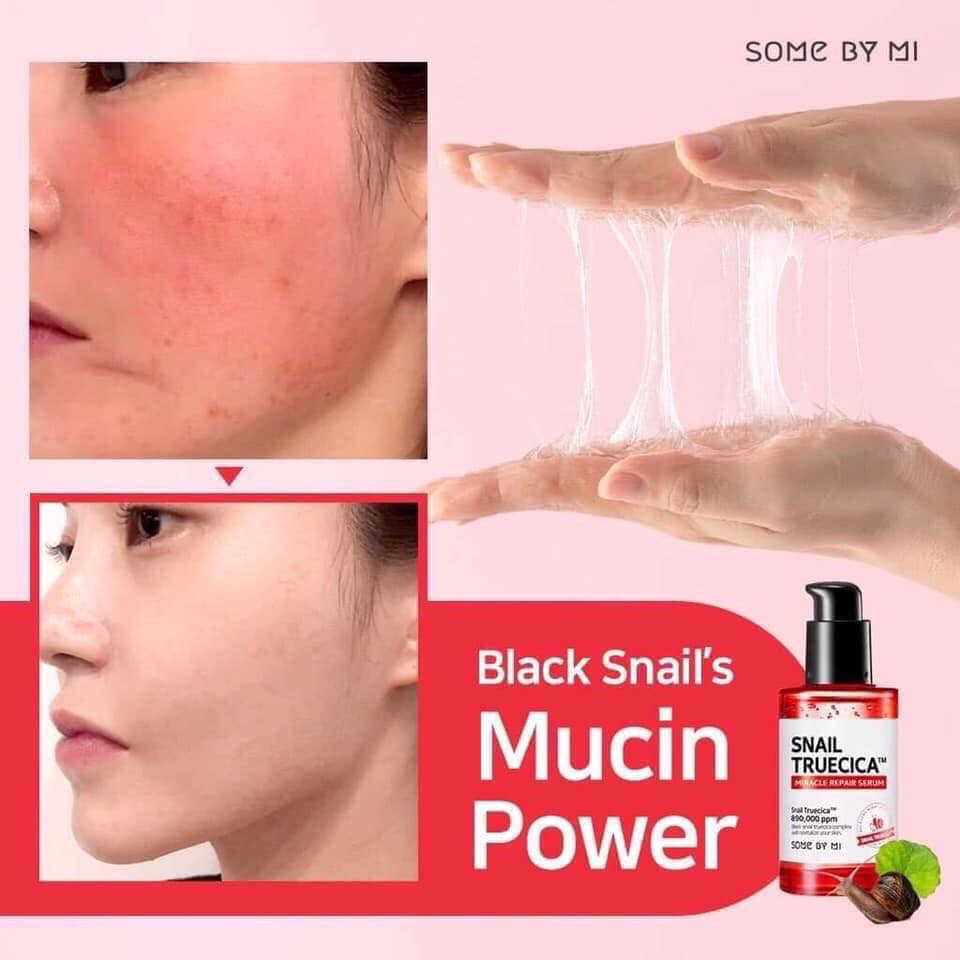 Tinh Chất Ốc Sên Phục Hồi Cải Thiện Thâm Sẹo Some By Mi Snail Truecica Miracle Repair Serum 50ml