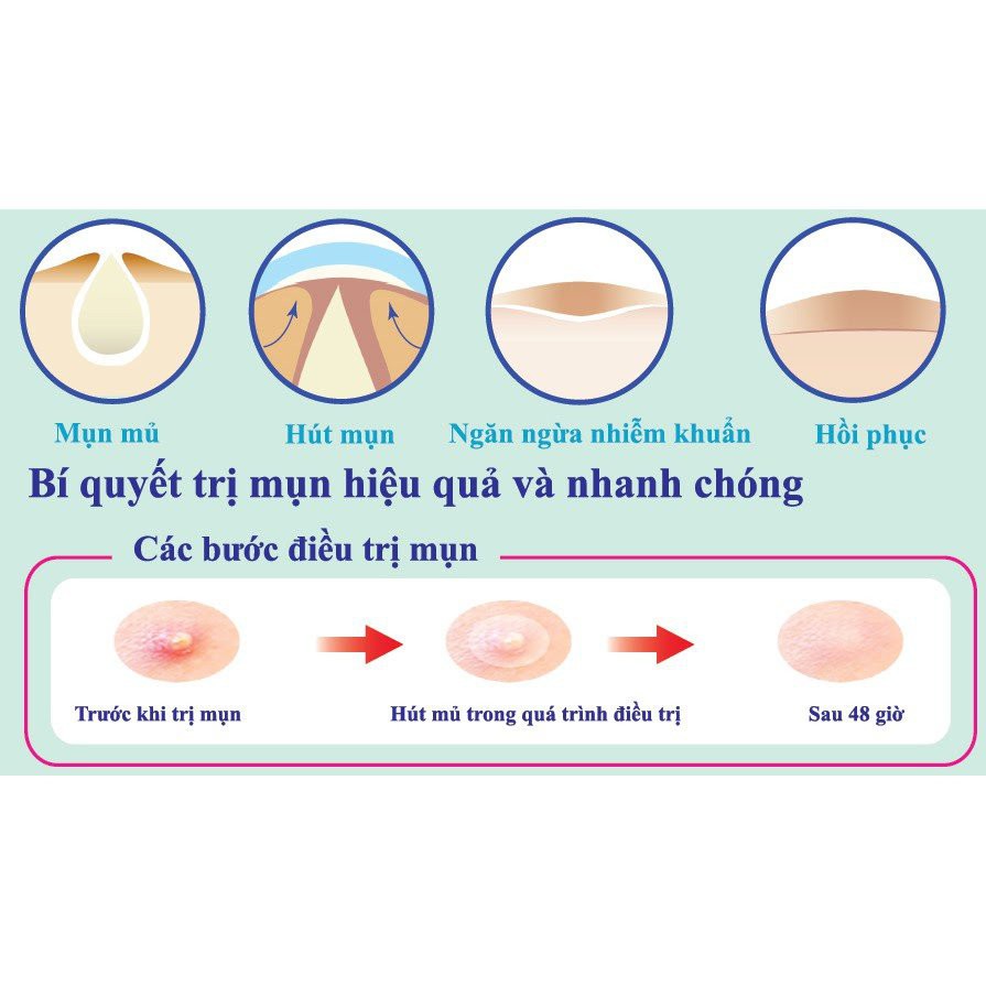 Miếng Dán Giảm Mụn Mayancare 20 Miếng (0.8cm)