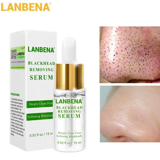 Tinh chất loại bỏ mụn đầu đen - Se khít lỗ chân lông Lanbena BlackHead Removing Serum EN