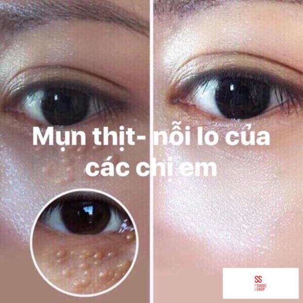 Kem làm mờ mụn thịt Tsubuporon Nhật Bản | BigBuy360 - bigbuy360.vn