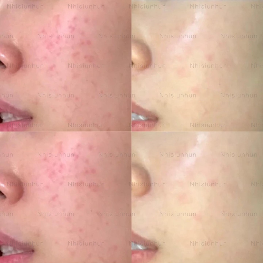 Bộ Kem dưỡng La Roche Posay Cicaplast Baume B5 - 40ml