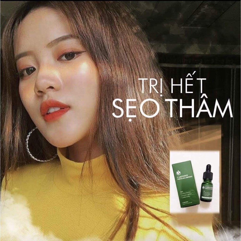 Serum trị mụn Caryophy 10ml | BigBuy360 - bigbuy360.vn