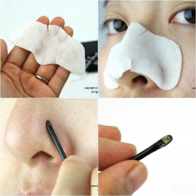 Miếng đẩy mụn đầu đen Blackhead (kèm cây nặn)