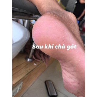 (giá sỉ) Dụng cụ chà/mài gót chân 4 in 1