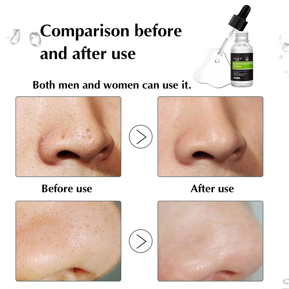 Tinh Chất Vàng 24k Lactobionic Acid Thu Nhỏ Lỗ Chân Lông Giảm Mụn Đầu Đen Dưỡng Ẩm Chống Lão Hóa 10