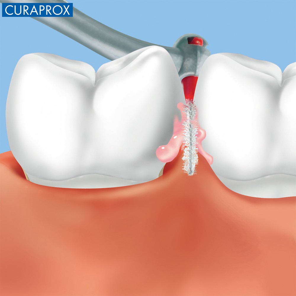 [Mã BMBAU50 giảm 7% đơn 99K] Bộ 5 Tăm Kẽ Răng Dành Cho Nha Chu Curaprox Period Plus 406 Kích Cỡ 1.7mm