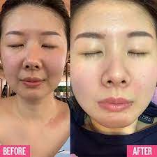 Serum chống lão hóa da La Roche Posay Retinol B3 Serum 30ml