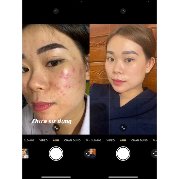 Serum Dưỡng Da Giảm Mụn Tinh Chất Khổ Qua Lim- Handmade - Sạch Mụn Mờ Thâm Se Khít Lỗ Chân Lông an toàn hiệu quả