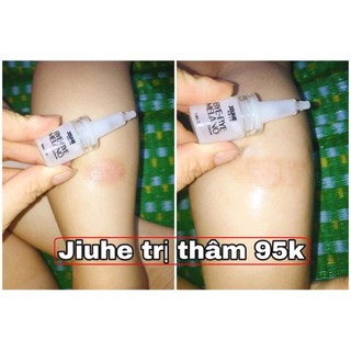 SERUM JIUHE THÂM BYE BYE MELANO