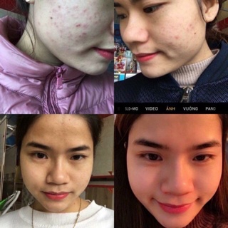 cốt sâm tái tạo da handmade