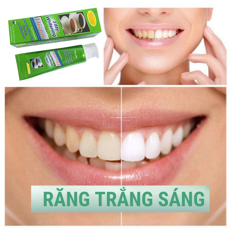 Kem bột đánh trắng răng thái lan brighten DISSAR chính hãng, loại bỏ mảng bám, ổ vàng, cao răng, răng vàng