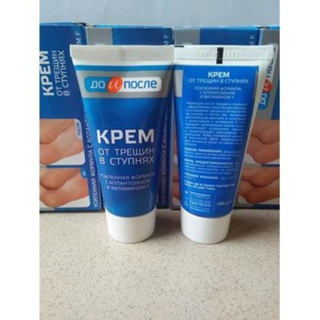 Kem Trị Nứt Gót Chân Nga Kpem 50ml