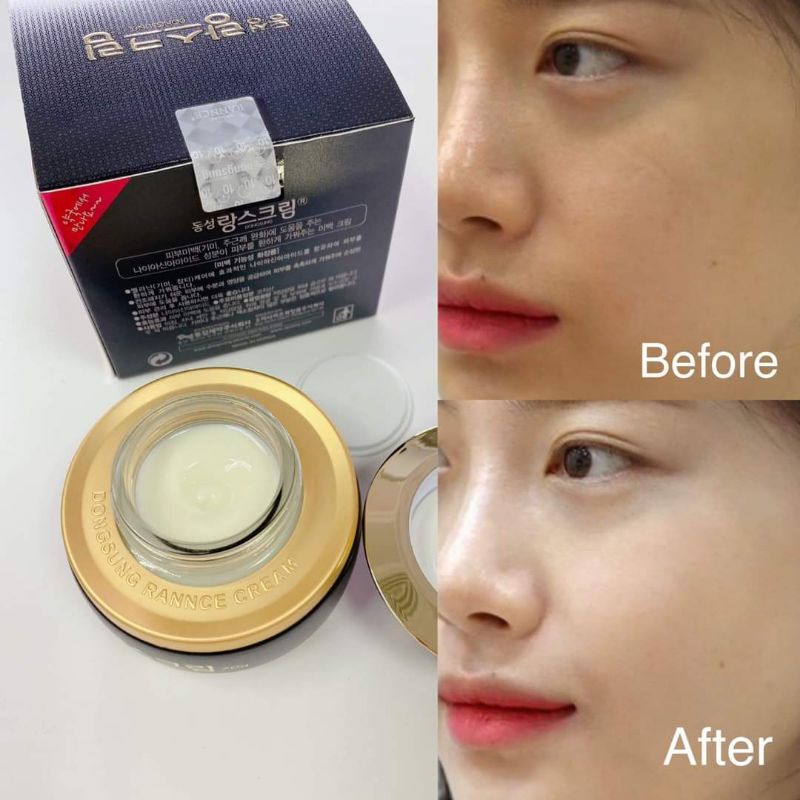 Kem Nám Dongsung Mẫu Cũ Hàn Quốc Hộp 70g