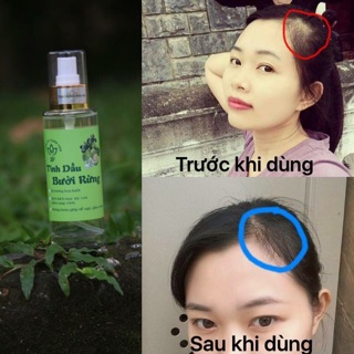 Tinh dầu bưởi rừng