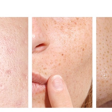 (BQY73124) Mặt Nạ Bùn Vị Trái Cây BIOAQUA-Hàng Mới Về