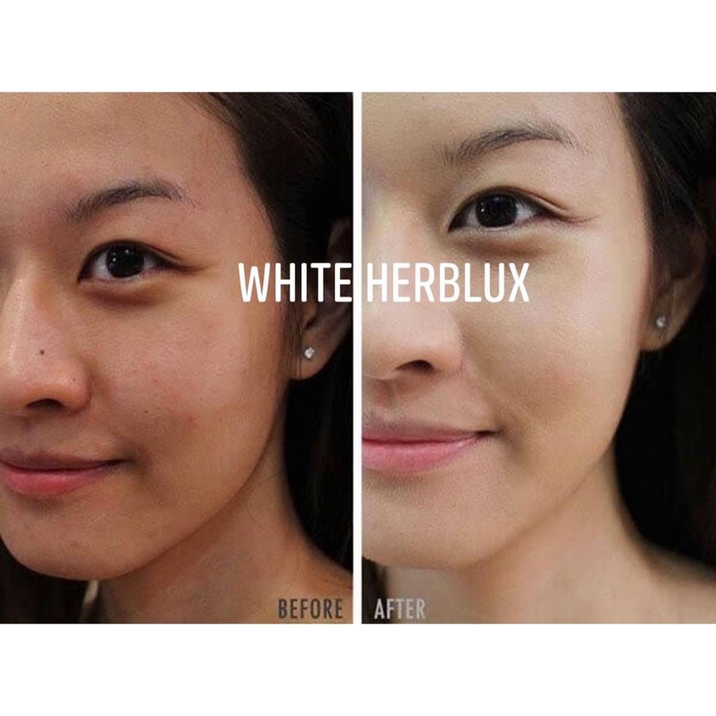 Viên Uống Trắng Da WHITE HERBLUX Trắng hồng, Căng mịn, Mờ Nám | WebRaoVat - webraovat.net.vn