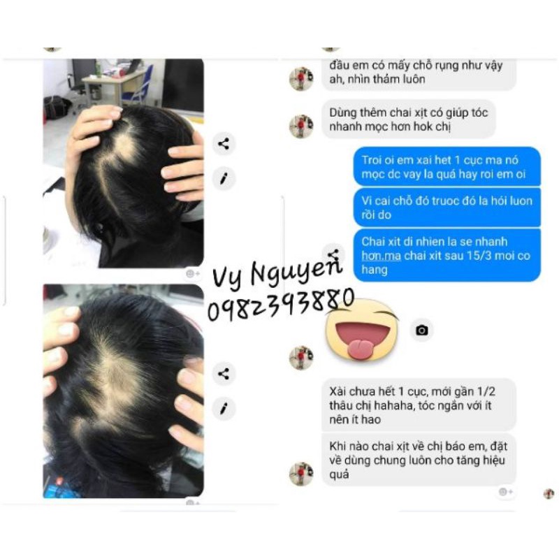 SAMPLE XÀ BÔNG CỤC NGỪA RỤNG TÓC THE SKIN HÀN QUỐC
