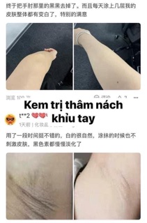 Kem trị thâm nách và đầu gối