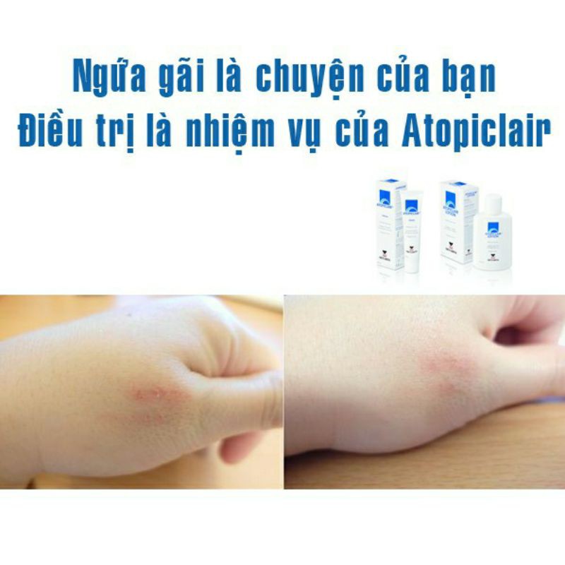 ✅[Chính Hãng]Kem Bôi Ngoài Da ATOPICLAIR
